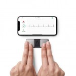 AliveCor’s KardiaMobile in use